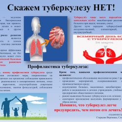 2 место ЭЛЕКТРОН 90002377 Страцева Вероника, Слободянюк Юлия Скажем туберкулёзу НЕТ! ___90002377